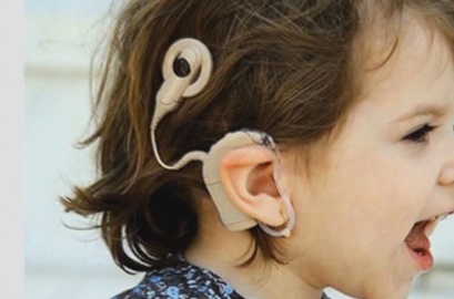 Potencial Evocado Auditivo de Estado Estável (PEAEE)