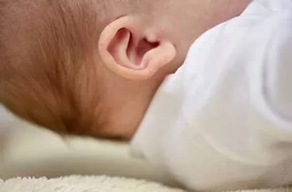 BERA/PEATE Click e Tone Burst (Potencial Evocado Auditivo de Tronco Encefálico)